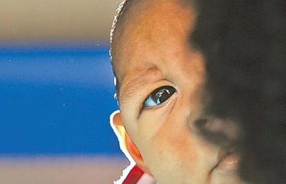 Bebês com microcefalia: quem vai cuidar deles?